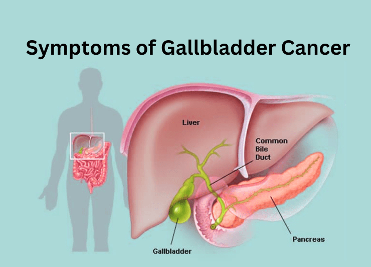 Gall Bladder Cancer